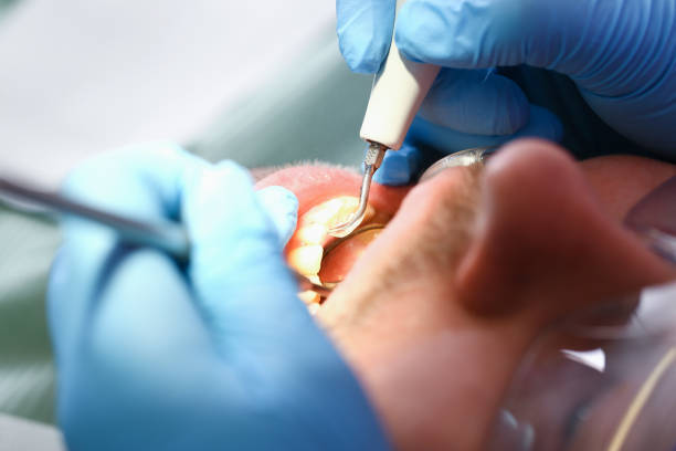 Best Emergency Treatment for Toothache in Crystal Falls, MI