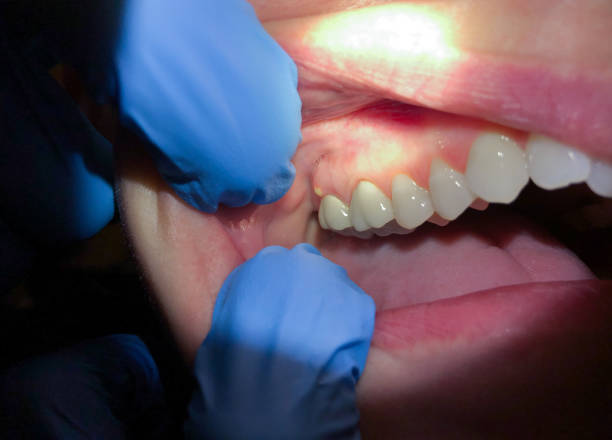 Best Walk-In Emergency Dentist in Crystal Falls, MI