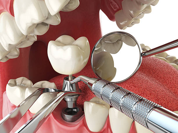 Best Weekend Emergency Dentist in Crystal Falls, MI